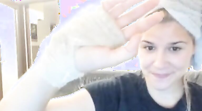 CHATURBATE BLONDE CAM GIRL SHOWS HER BANDAGE